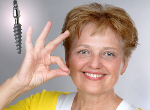 Cheap same day dental implants