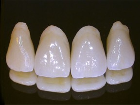 Dental Crown