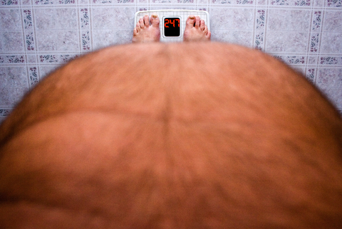 Low Cost Gastric Bypass Mexico