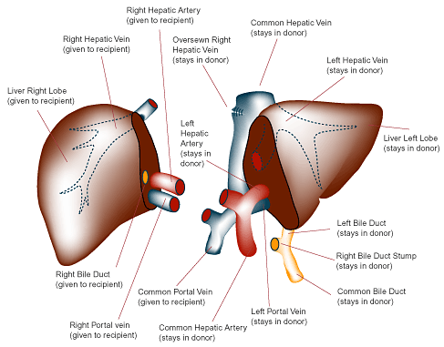 liver-transplant liver transplant