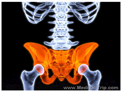 Hip Replacement Surgery