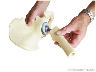Hip Joint Hip Joint