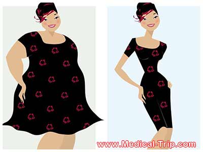 Tummy Tuck in Mexico